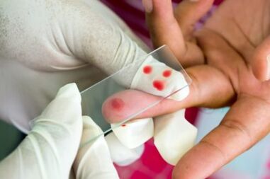 Diagnose van pijn in de gewrichten van de vingers