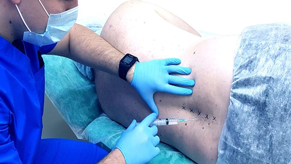 Spinaal blok voor osteochondrose