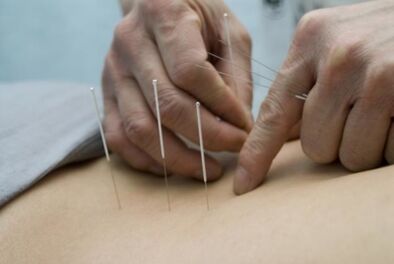 Acupunctuur voor osteochondrose van het thoracale gebied