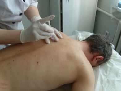 Intra-articulaire injecties van chondroprotectors voor thoracale osteochondrose