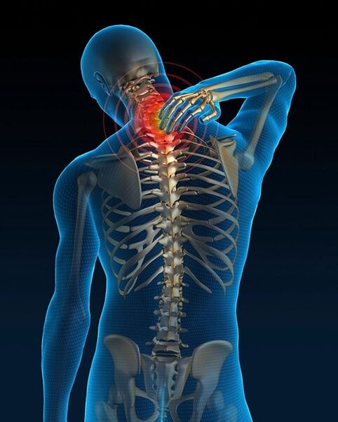 In de beginfase van de behandeling van cervicale osteochondrose neemt de pijn in de nek toe