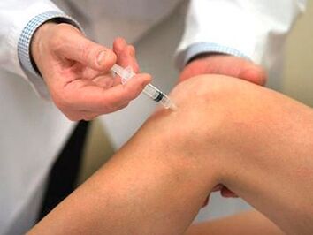 injectie in het kniegewricht bij artrose